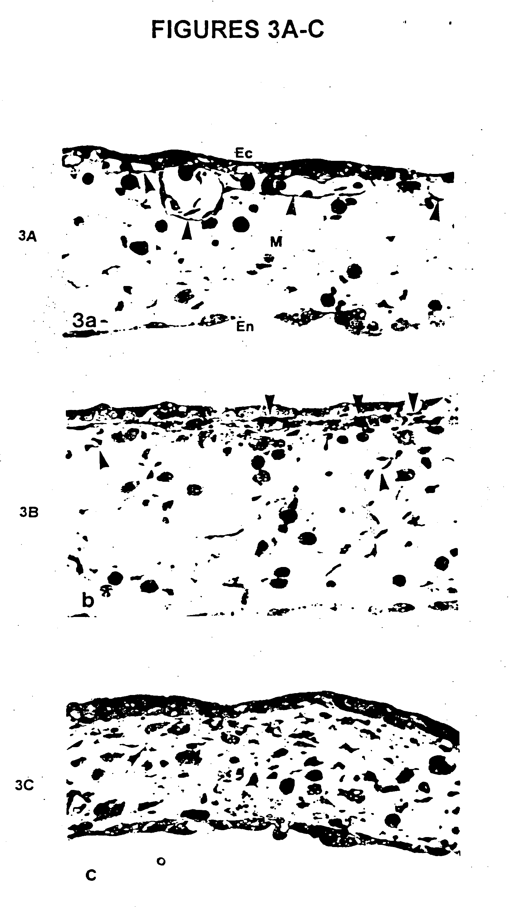 Anti-angiogenic compositions and methods of use