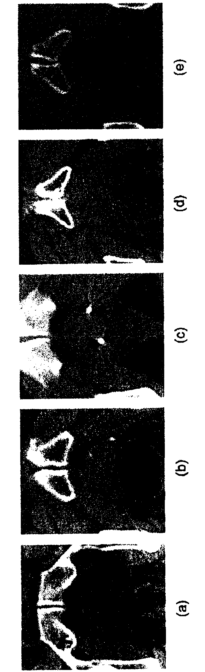 Systems and methods for automatic contouring in adaptive radiation therapy