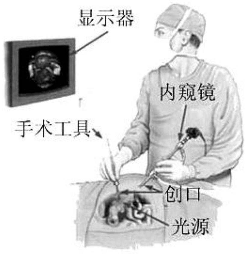 A method of body surface projection virtual transparent observation of inner cavity in minimally invasive surgery