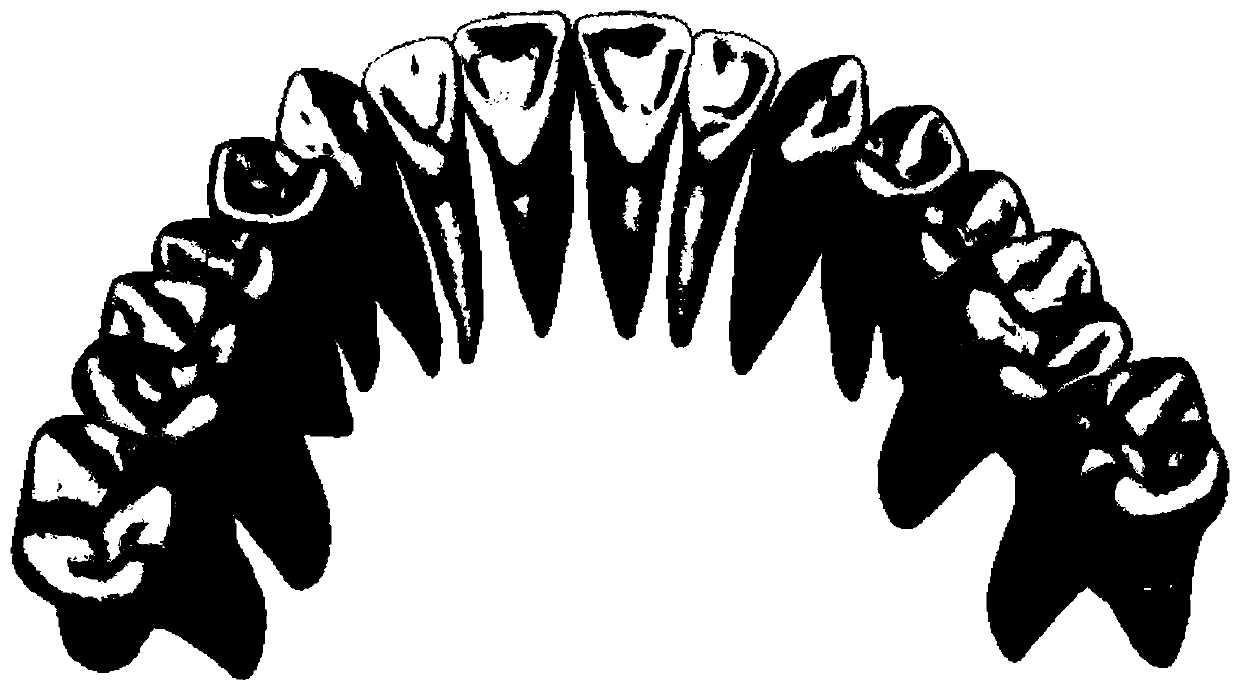 An Algorithm for Constructing the Local Coordinate System of Teeth Using Standard Model Library