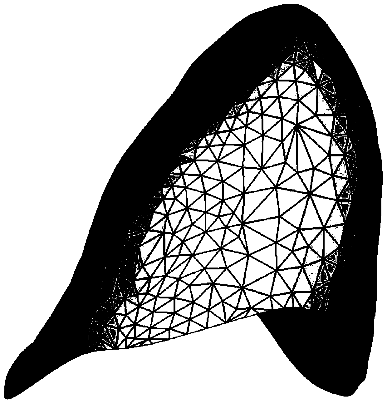 An Algorithm for Constructing the Local Coordinate System of Teeth Using Standard Model Library