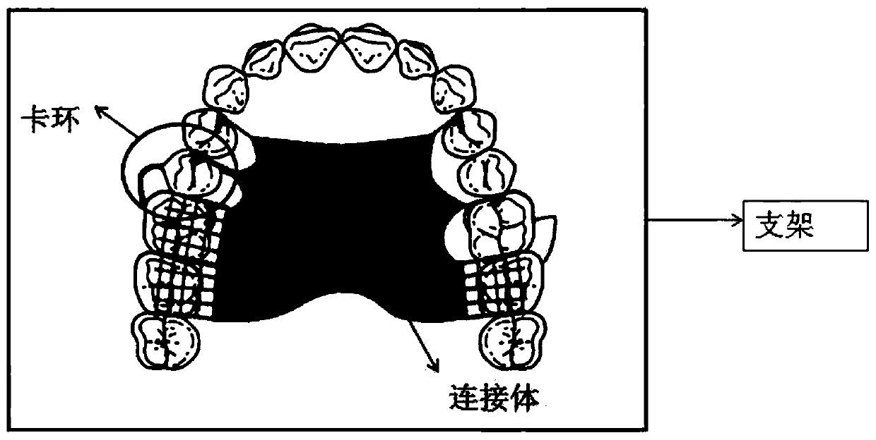 A false tooth restoration scheme design method and system based on data decision