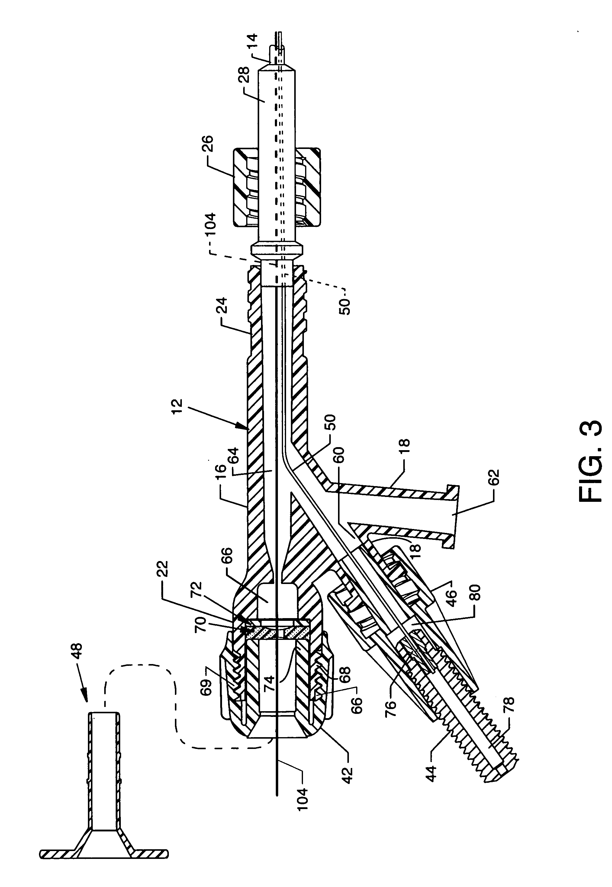 Miniature flexible thrombectomy catheter