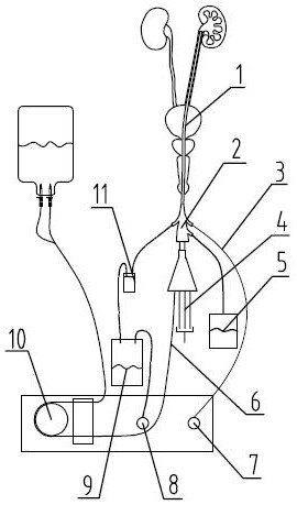 An automatic pressure-regulating gravel cleaning system