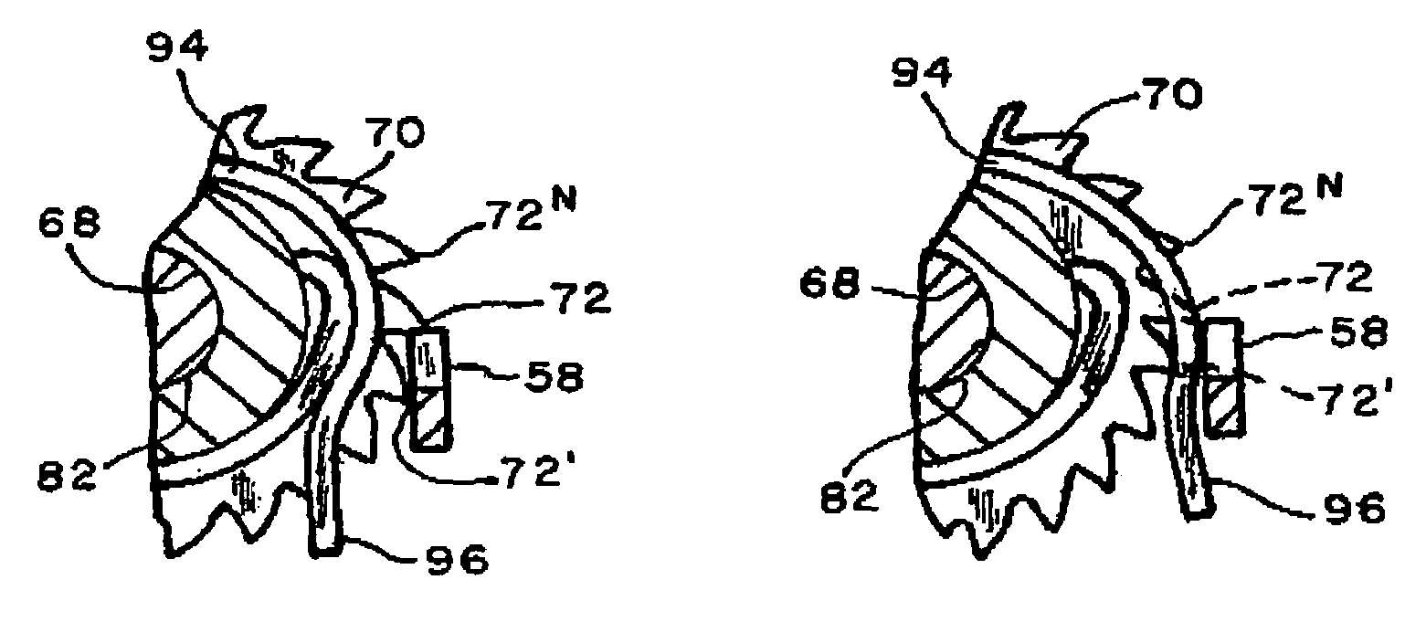 Drum brake