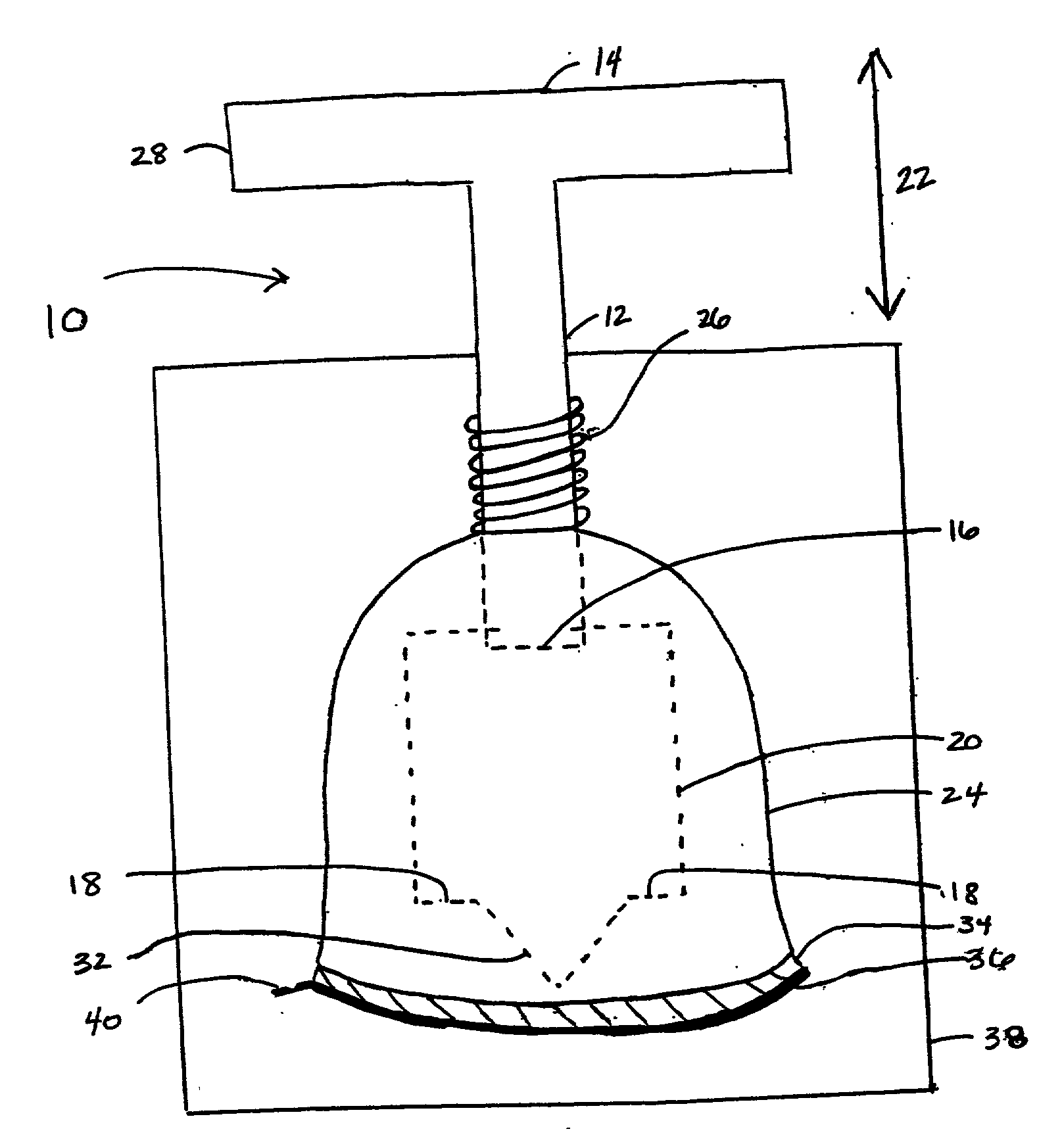 Methods and apparatus for intercostal access