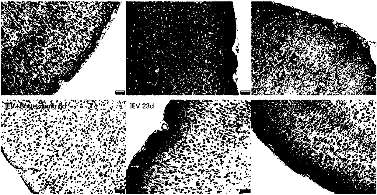 Application of 20S proteasome inhibitor in preparing medicine for treating Japanese B encephalitis virus infection