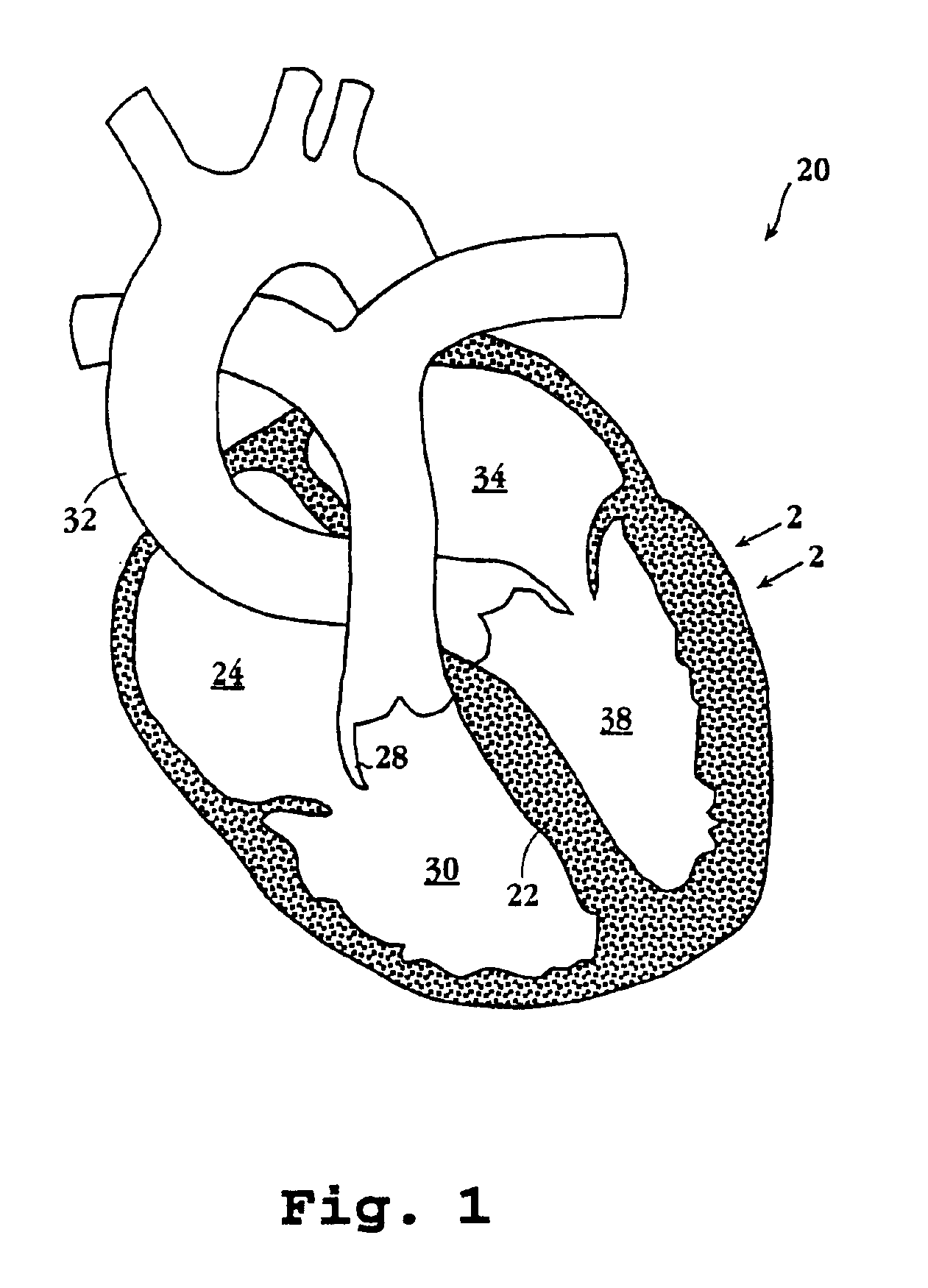 Method and monitor for enhancing angiogenesis in the heart by exercise follow-up