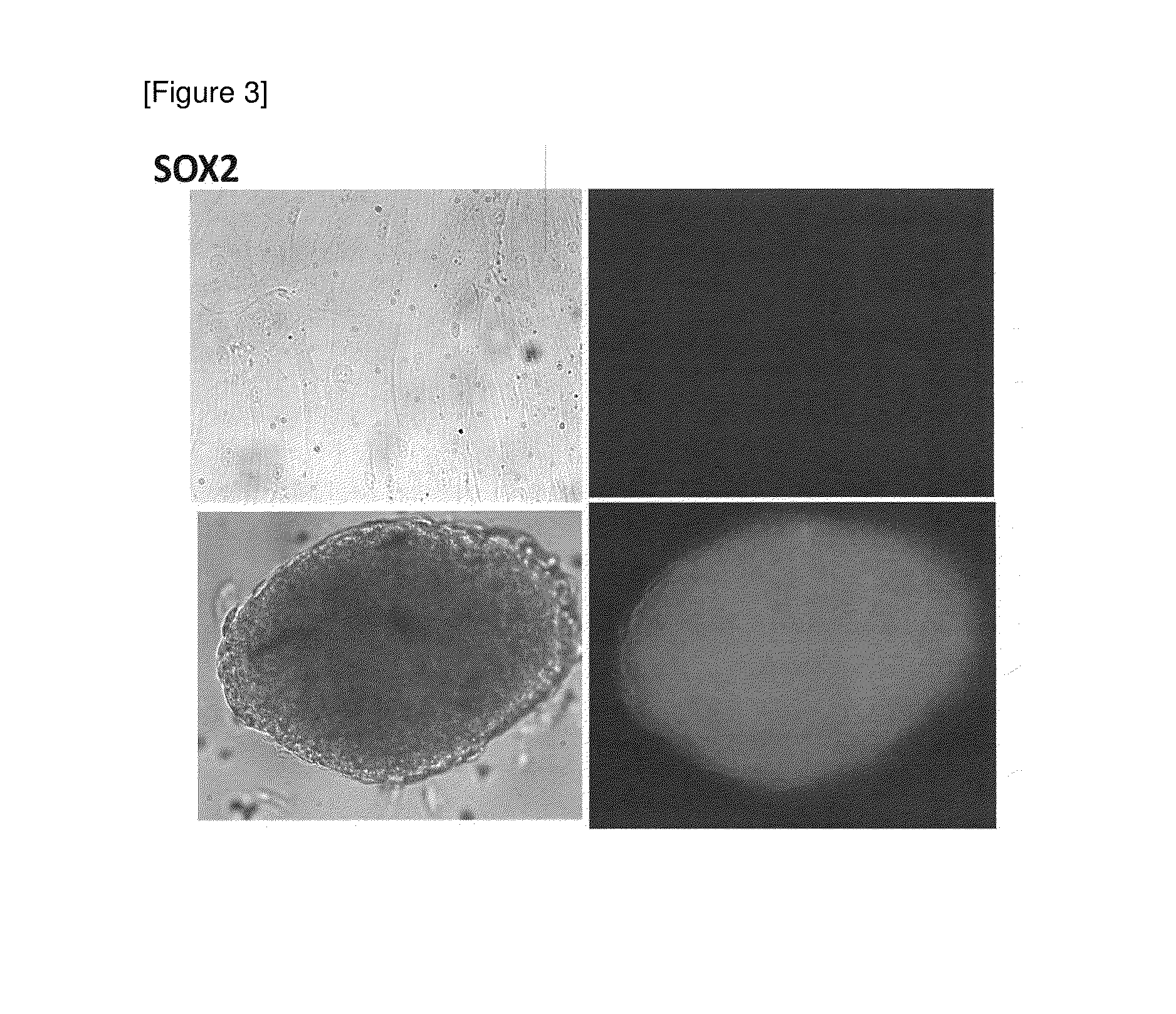 Method for preparing pluripotent stem cells