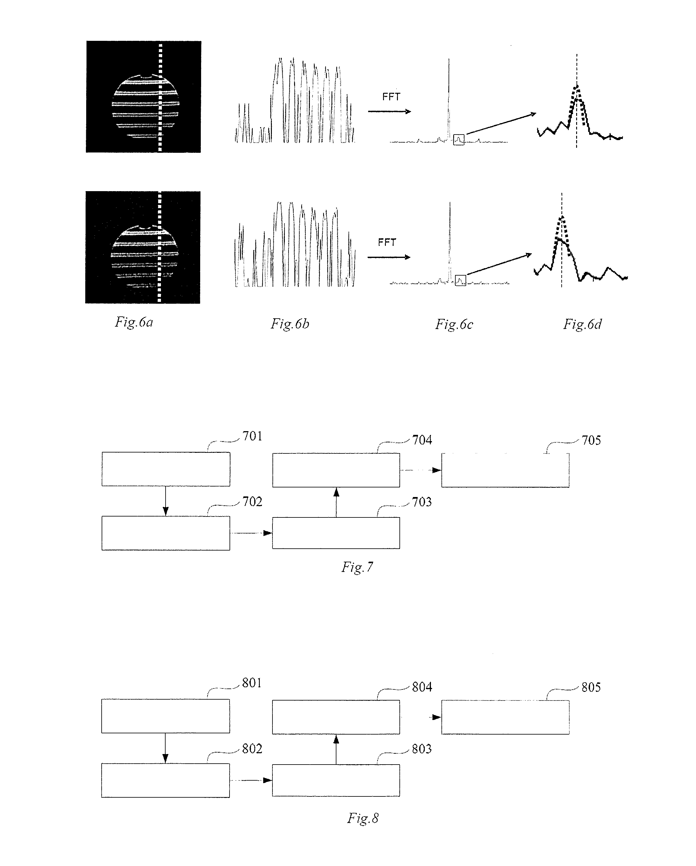 Method for correcting image distortion and system, and magnetic resonance imaging equipment