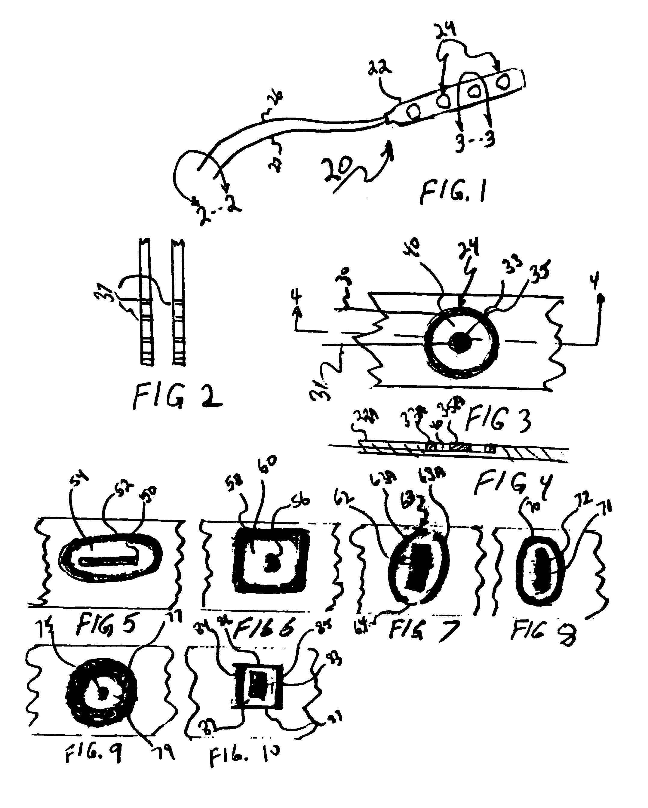 Neurostimulation lead with concentric electrodes