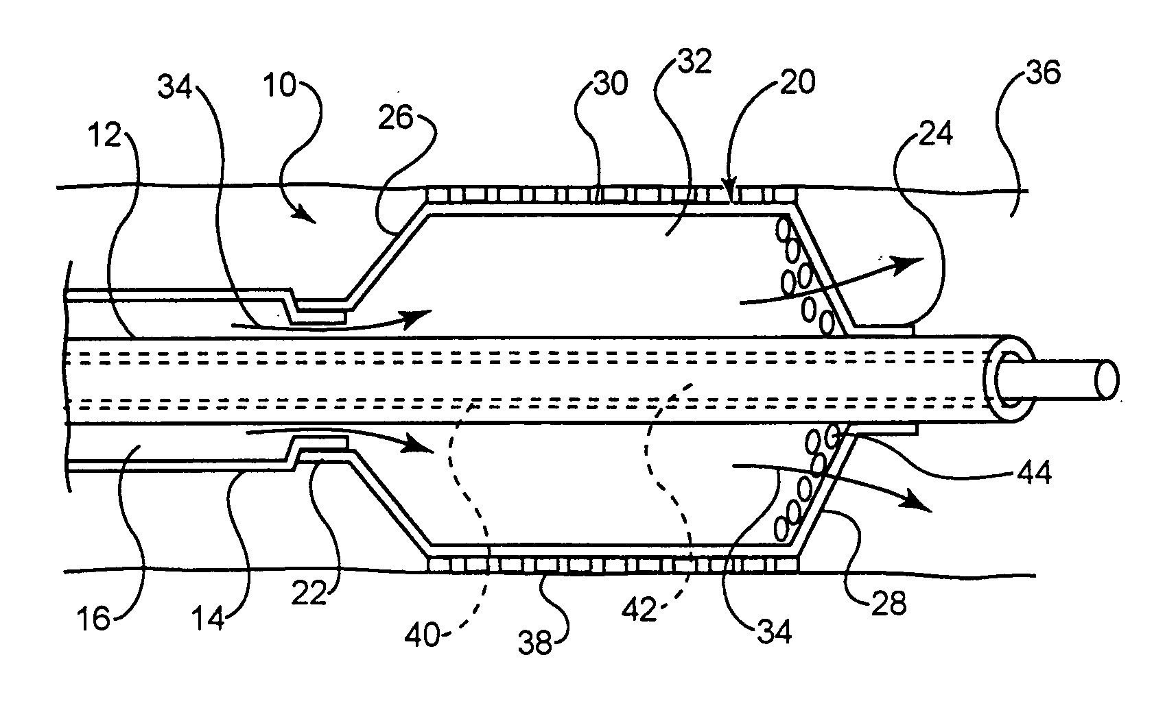 Intravascular dilatation infusion catheter