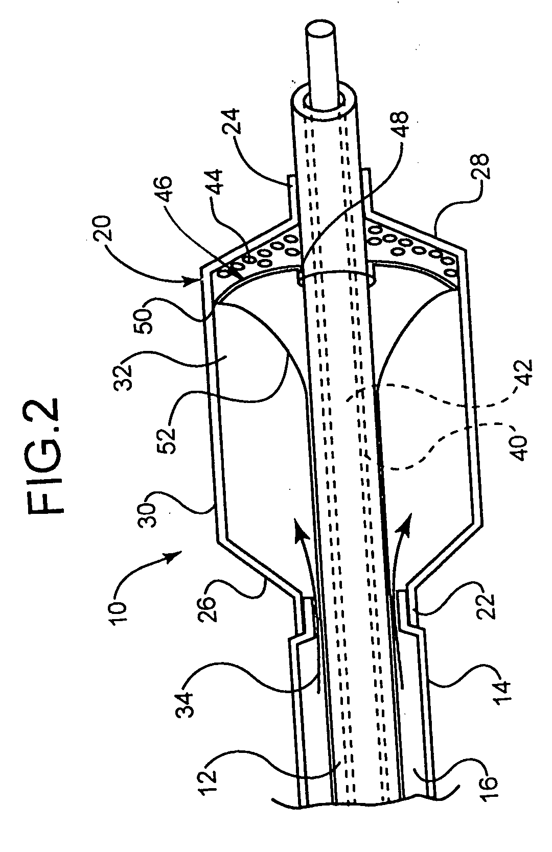 Intravascular dilatation infusion catheter