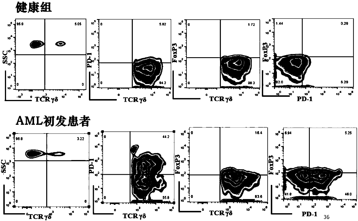 Application of novel gamma delta T cell to preparation of kit for evaluating curative effect of AML (acute myeloid leukemia)