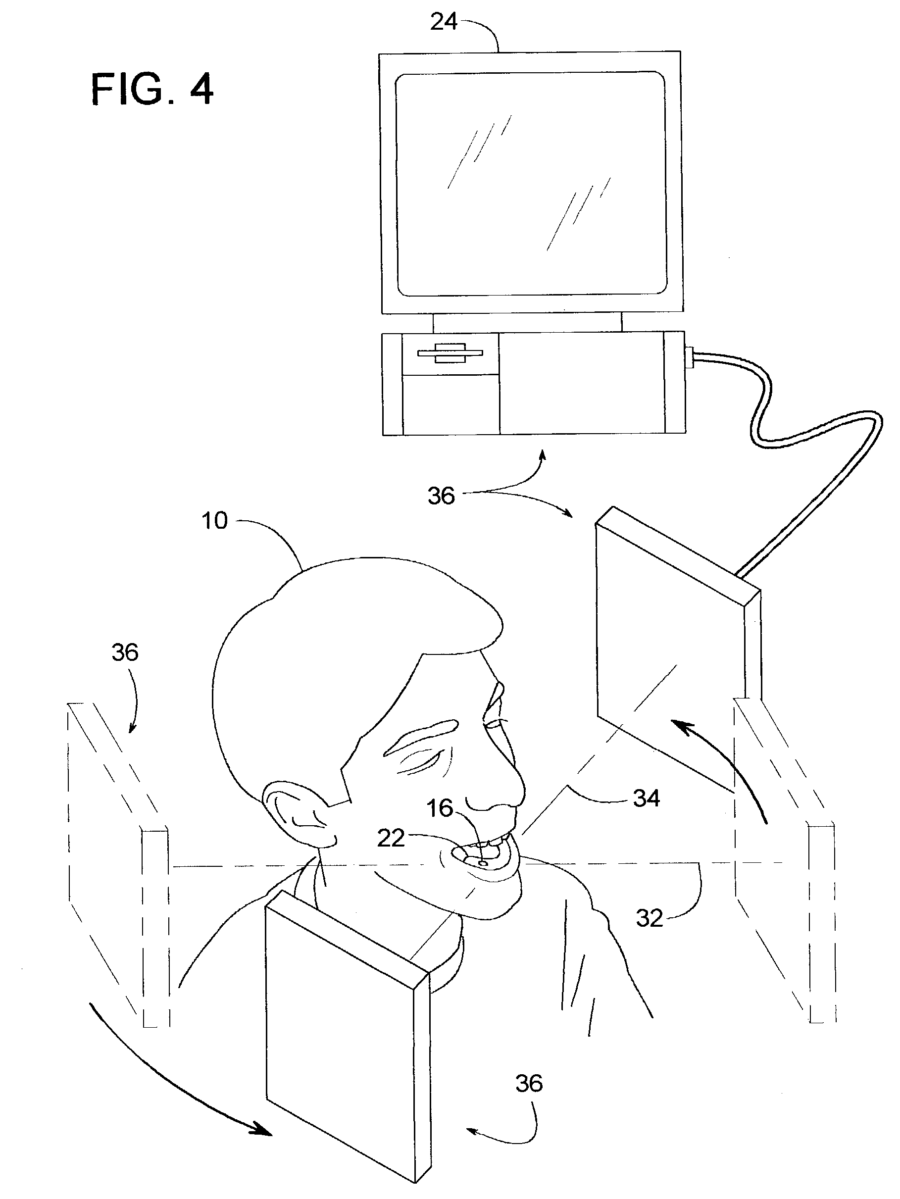 Method of installing a dental implant