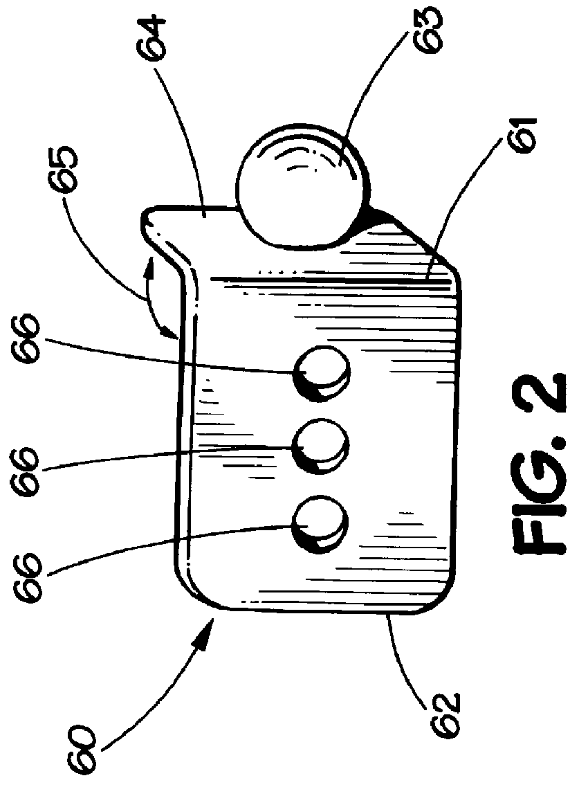 Modular mandibular prosthesis