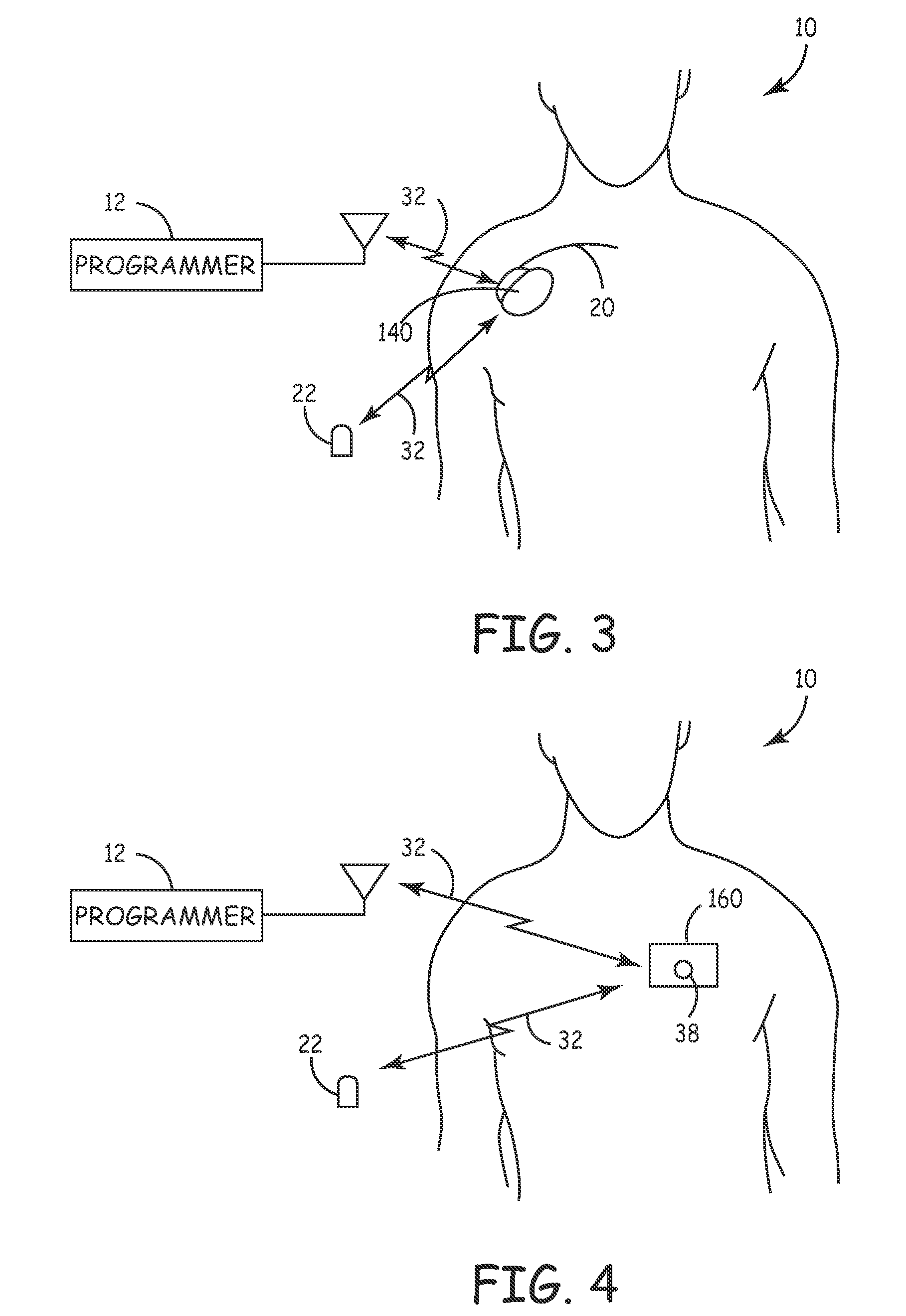 System and method for regulating cardiac triggered therapy to the brain