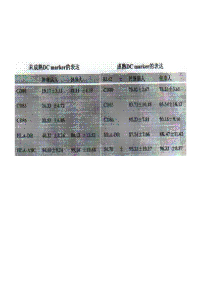 Preparation of specific tumor killing cell