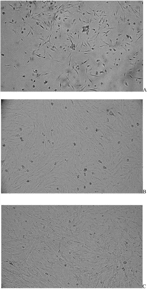 Method for separating exosome from human umbilical cord mesenchymal stem cell source and reagent used by method