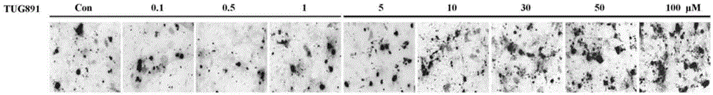 Application of GPR120 agonist TUG891 to prevention and treatment of osteoporosis