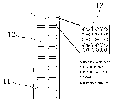 Combined general check protein chip for early-stage cancers mainly comprising lung cancer