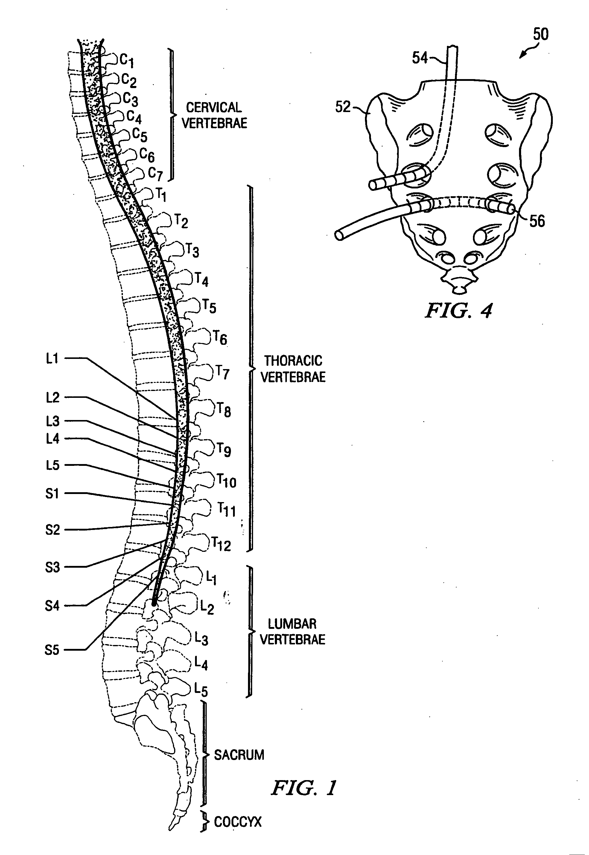 System and method for treatment of sexual dysfunction