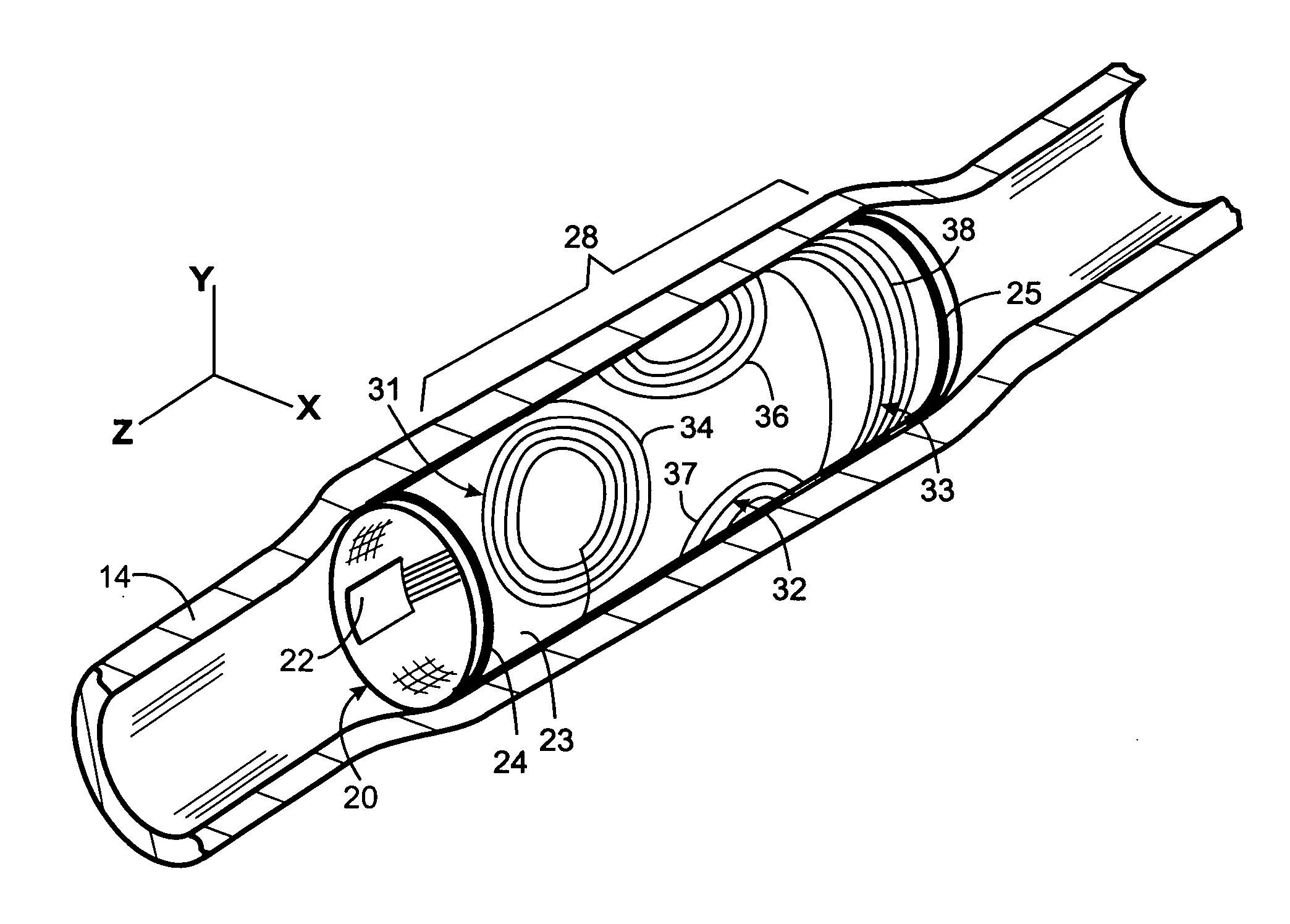 Implantable medical apparatus having an omnidirectional antenna for receiving radio frequency signals