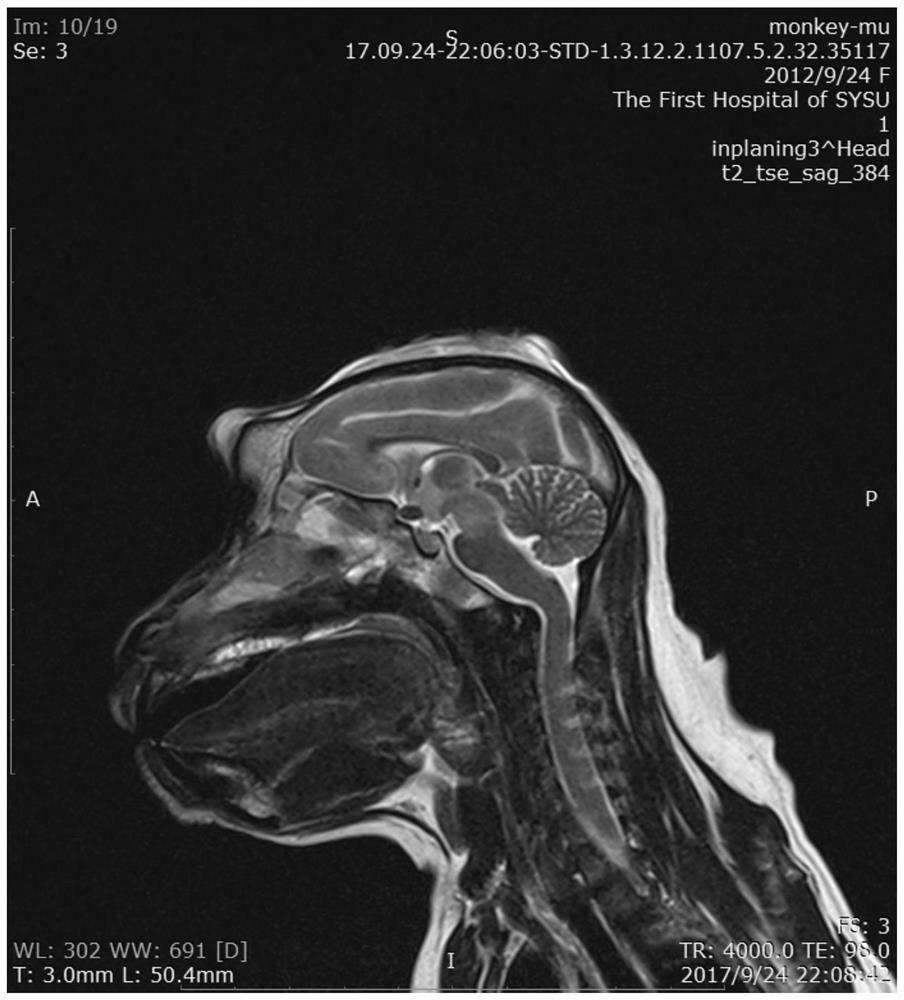 A method for localizing the substantia nigra region of the non-human primate brain