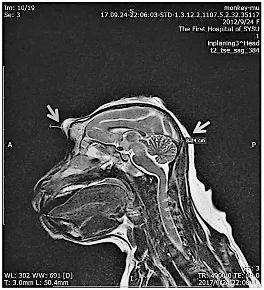 A method for localizing the substantia nigra region of the non-human primate brain