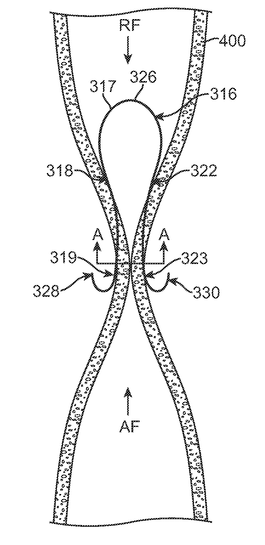 Apparatus and methods for creating a venous valve from autologous tissue