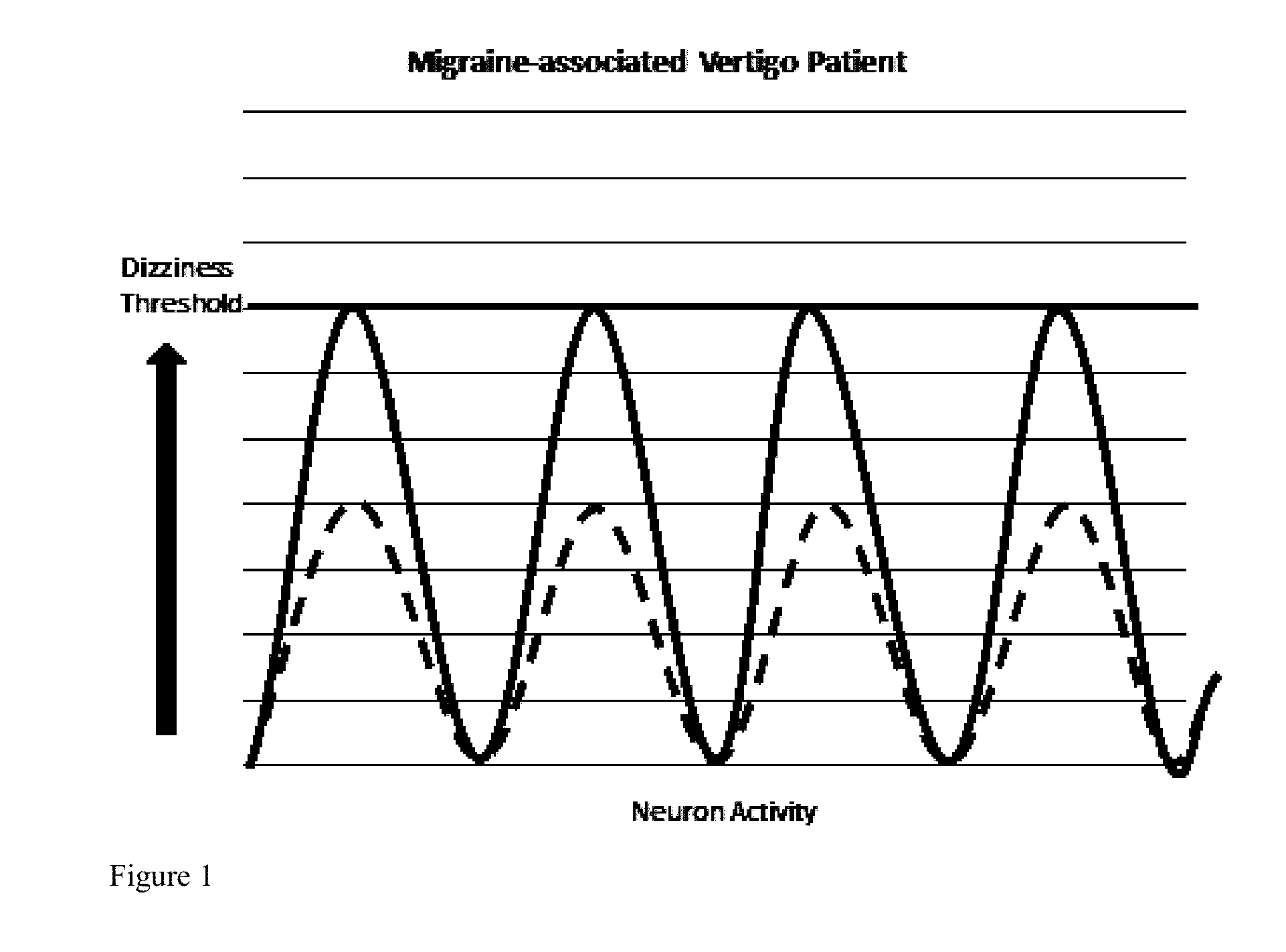 Compositions and methods for prophylaxis and therapy for menieres disease