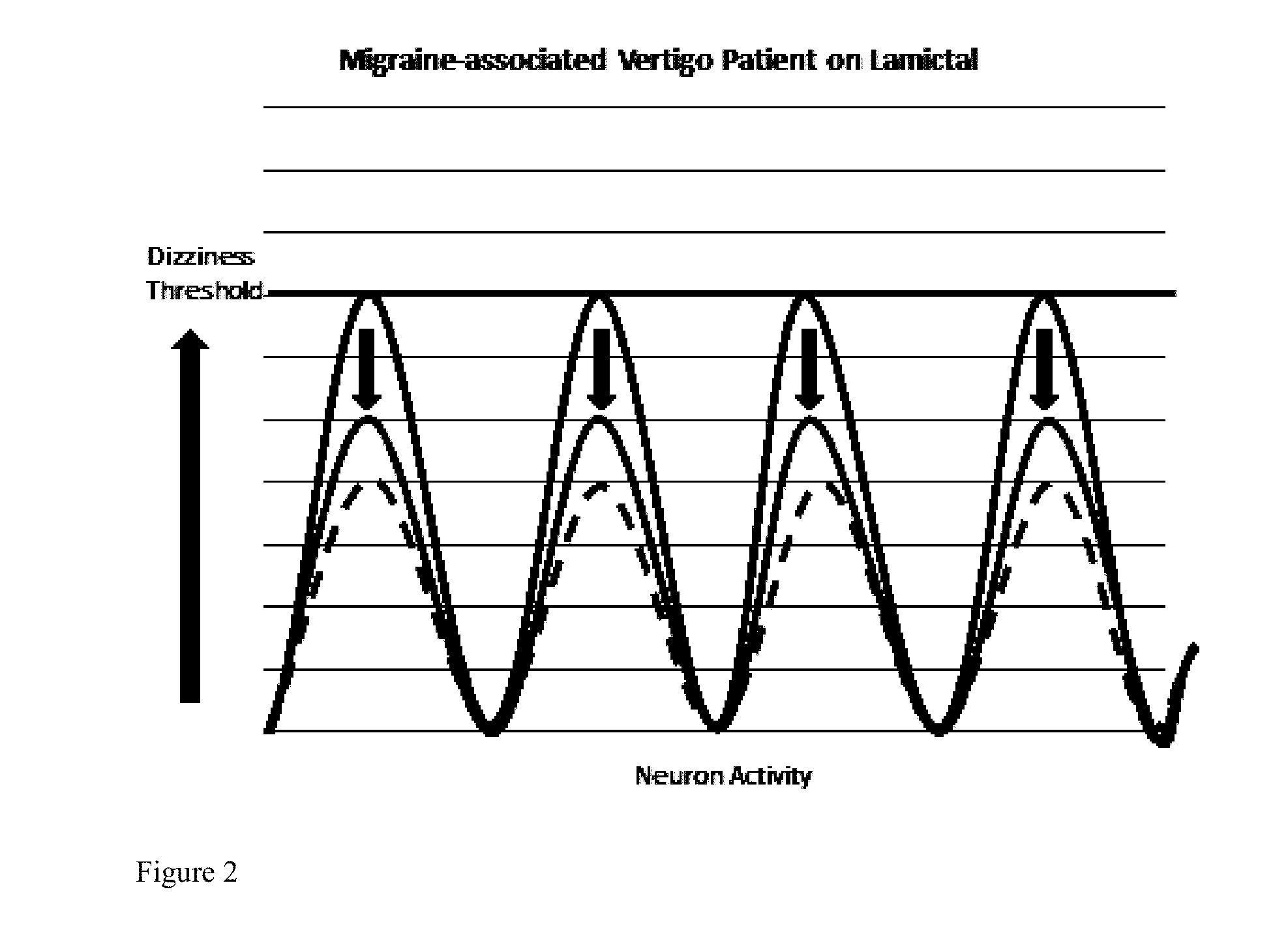 Compositions and methods for prophylaxis and therapy for menieres disease