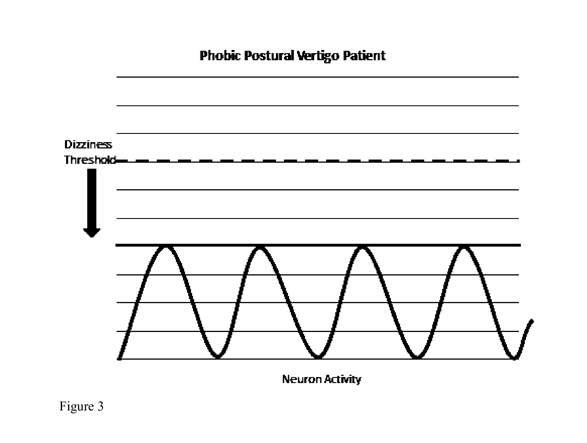 Compositions and methods for prophylaxis and therapy for menieres disease