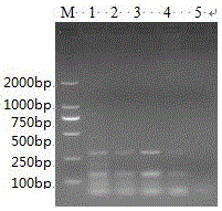 Dual PCR method for detecting theileria hirci and anaplasma