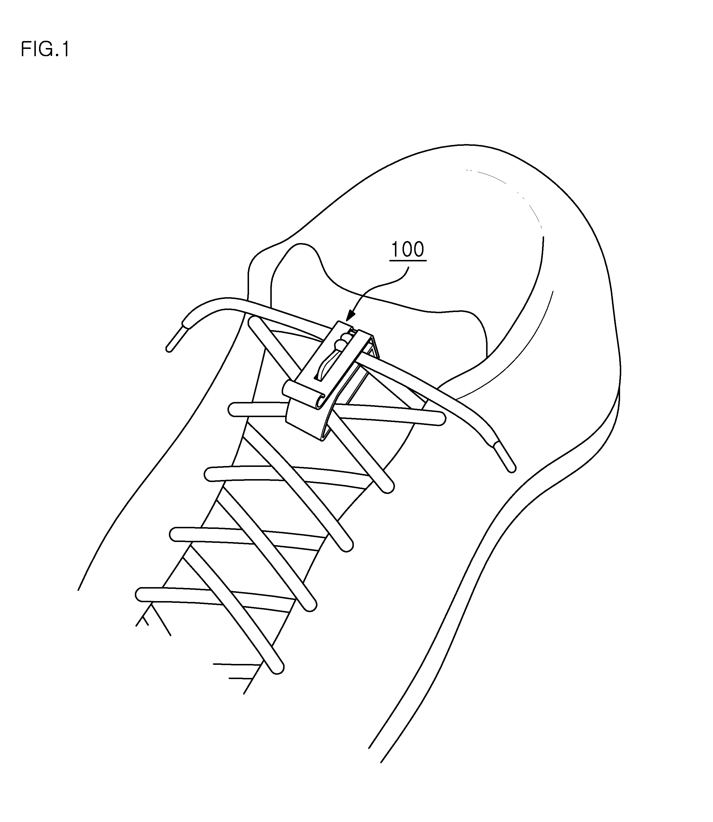 Shoelace retaining device