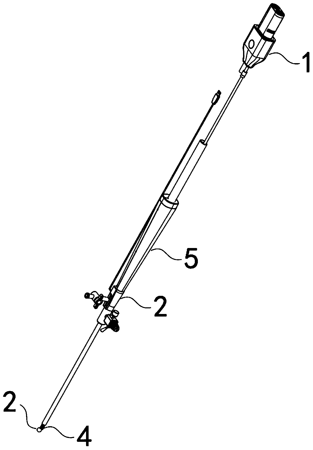 Hysterectomy