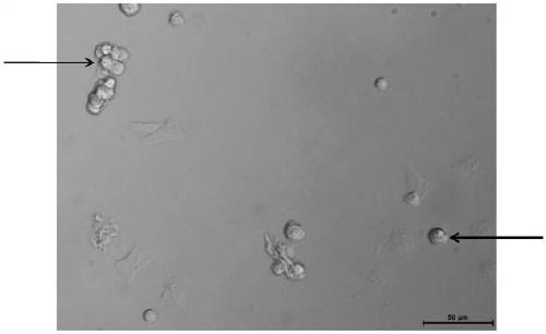 Method for acutely separating rat and suckling mouse cardiomyocytes