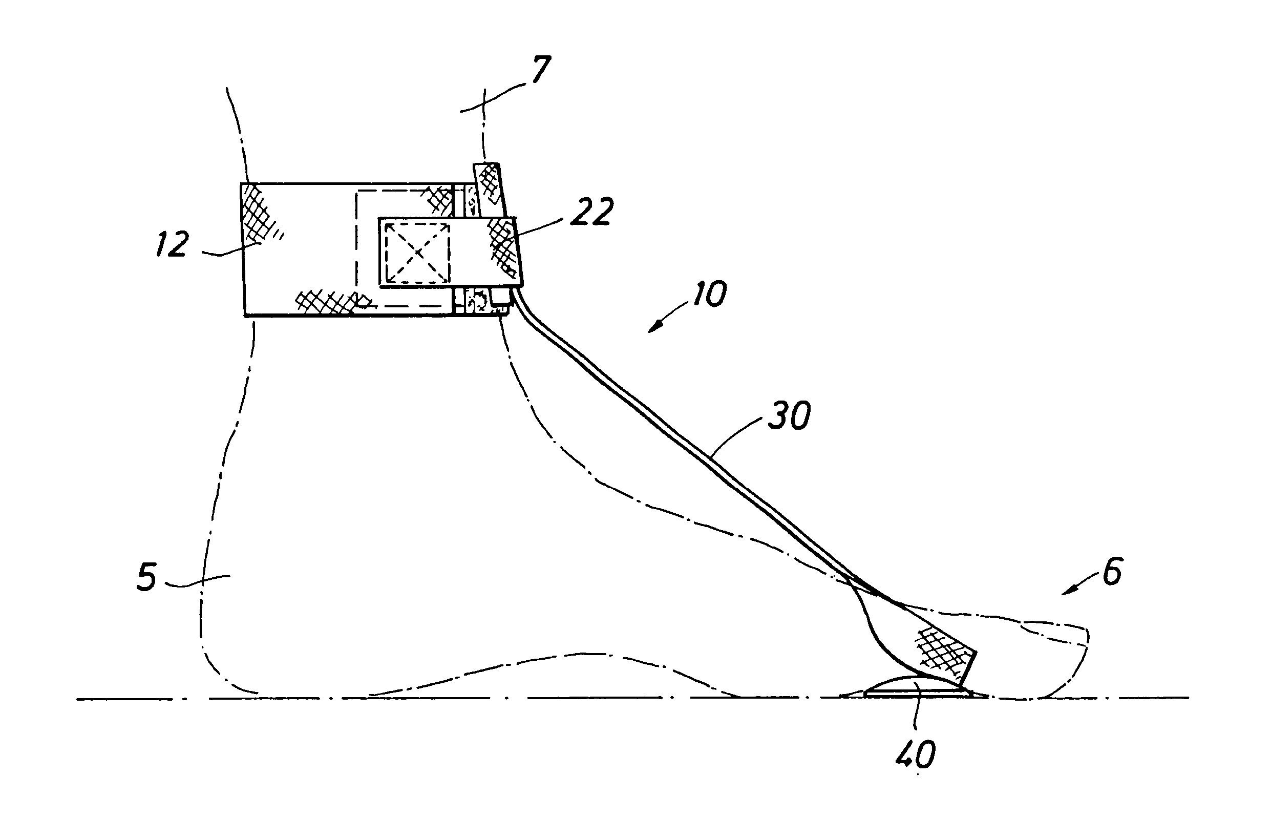 Foot drop assistance device