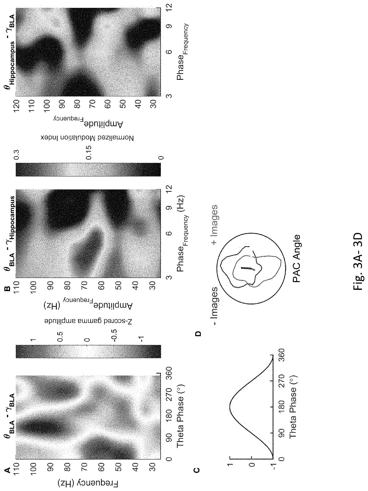 Compositions and Methods for Treatment of Post-Traumatic Stress Disorder using Closed-Loop Neuromodulation