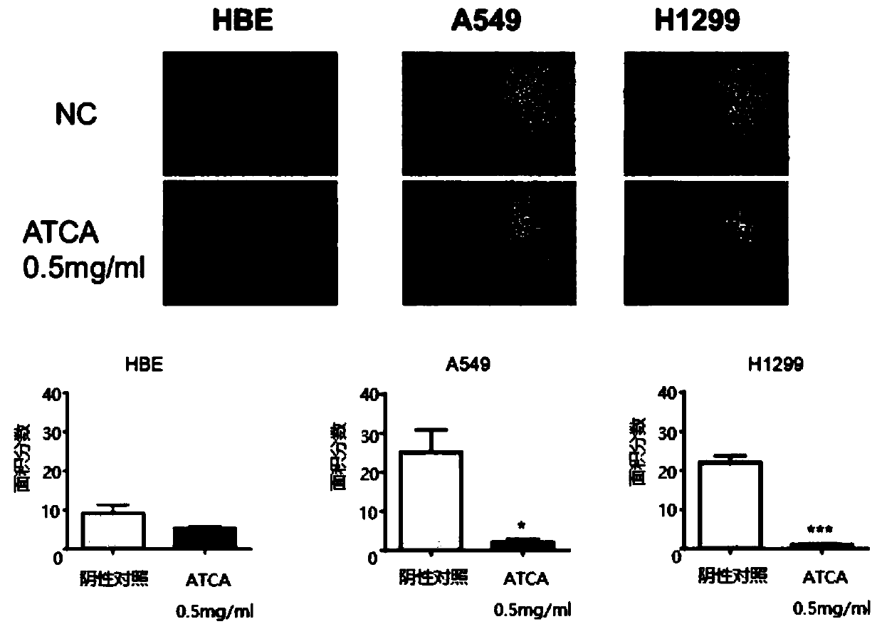 Purpose of ATCA to preparation of medicines for tumors