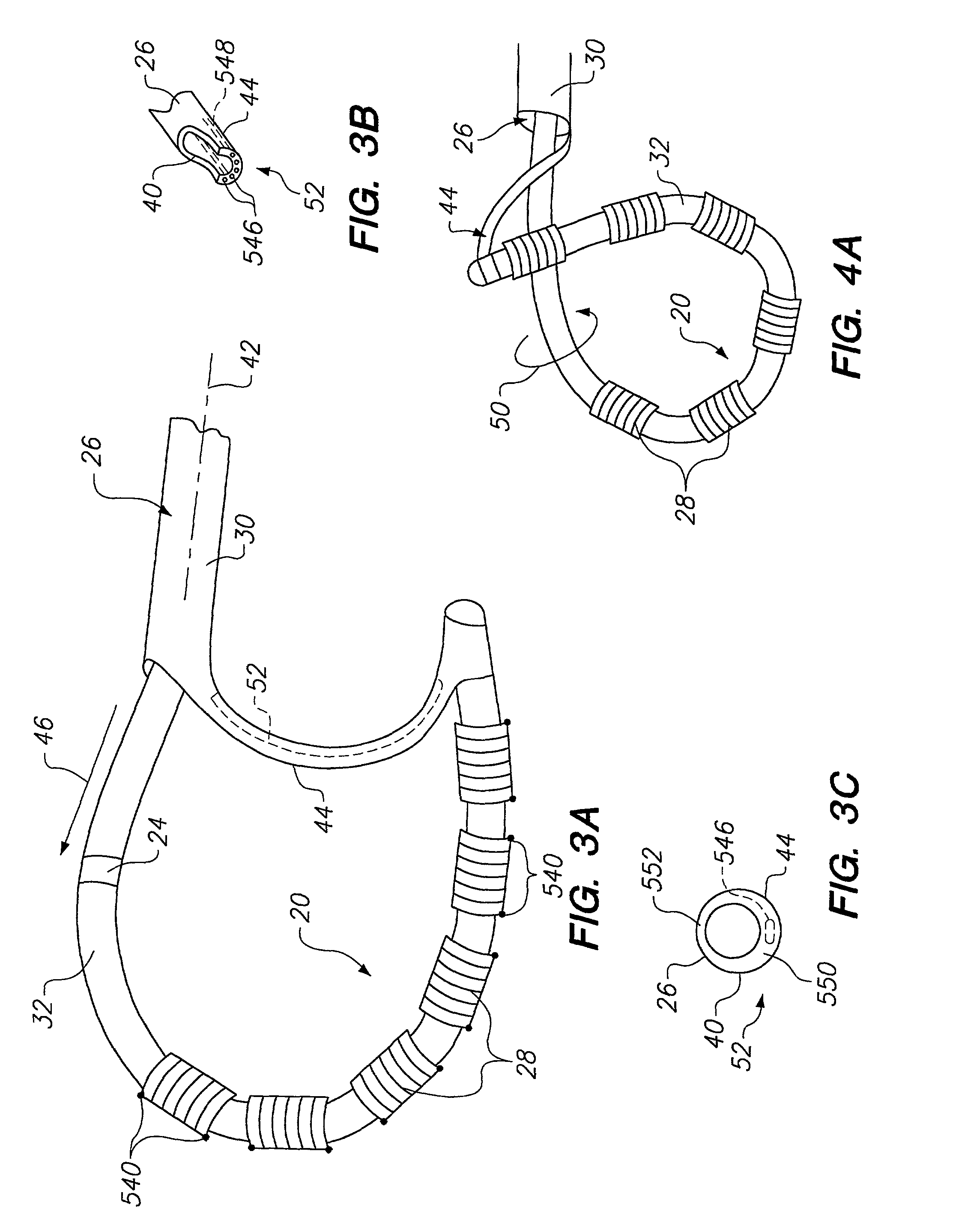 Loop structures for supporting multiple electrode elements