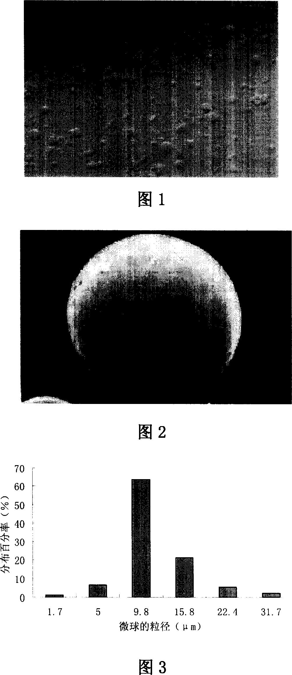 Enrofloxacin gelatine microball and its preparation method