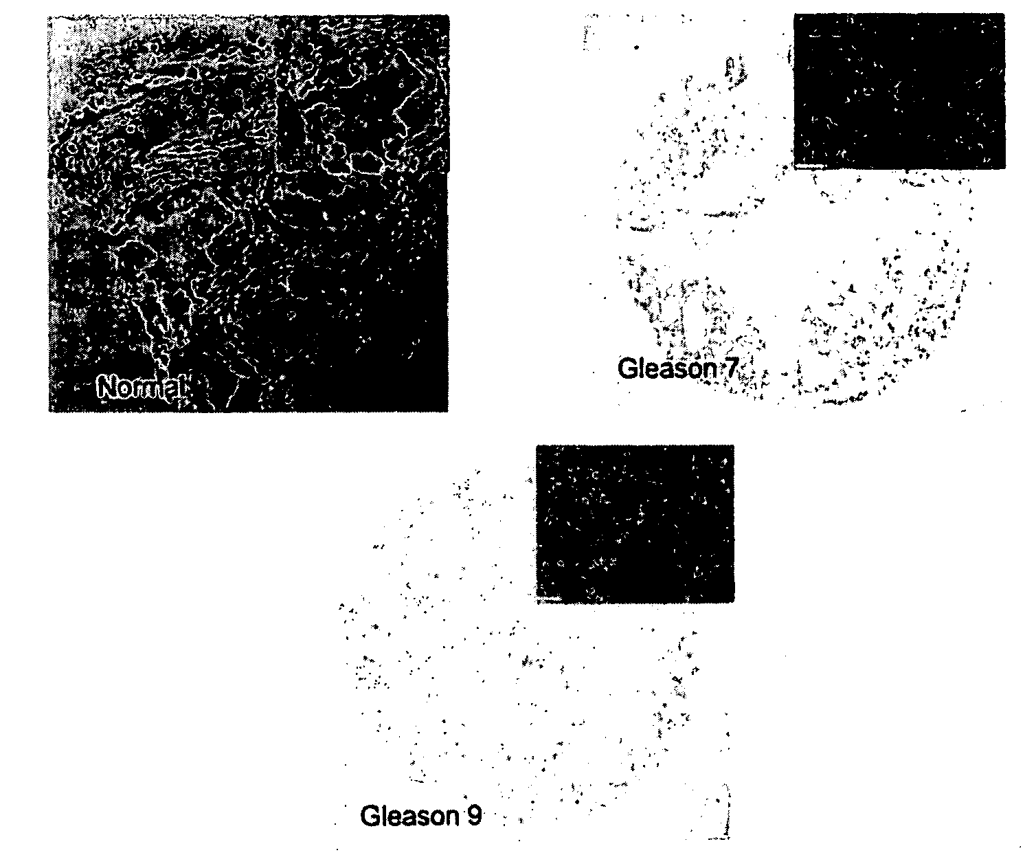 Compositions and methods of use of epb1, and erbb3 binding protein