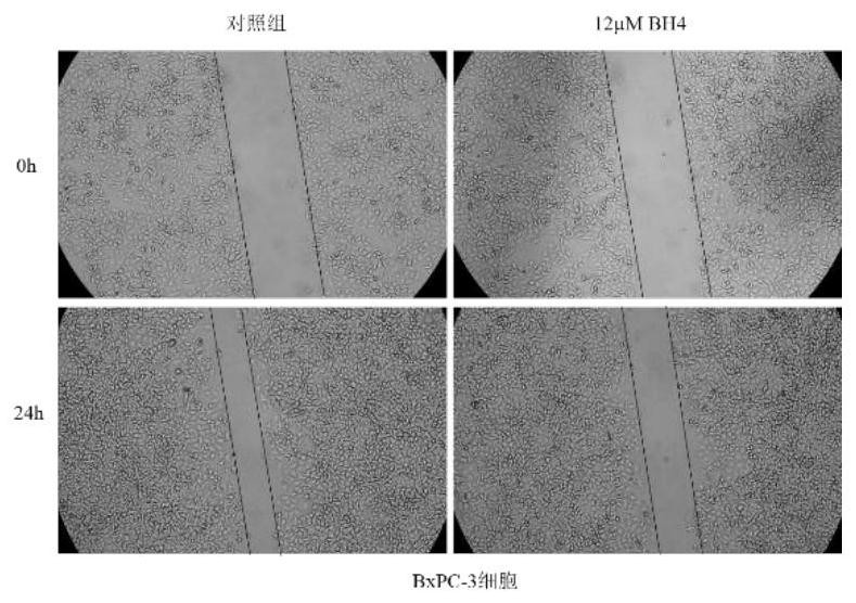 Promoter for reducing malignant phenotypes of pancreatic cancer cells, pharmaceutical composition and application thereof