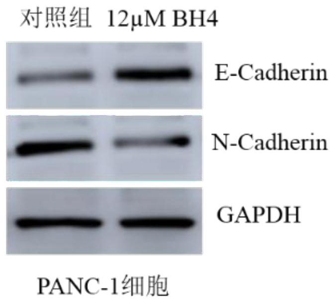 Promoter for reducing malignant phenotypes of pancreatic cancer cells, pharmaceutical composition and application thereof