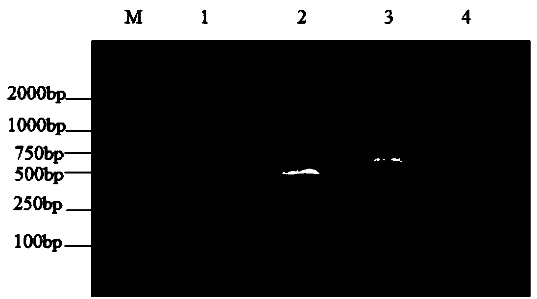 Antigen region for processing destroyed beta-conglycinin alpha'subunit based on phage showing technology positioning and screening method thereof