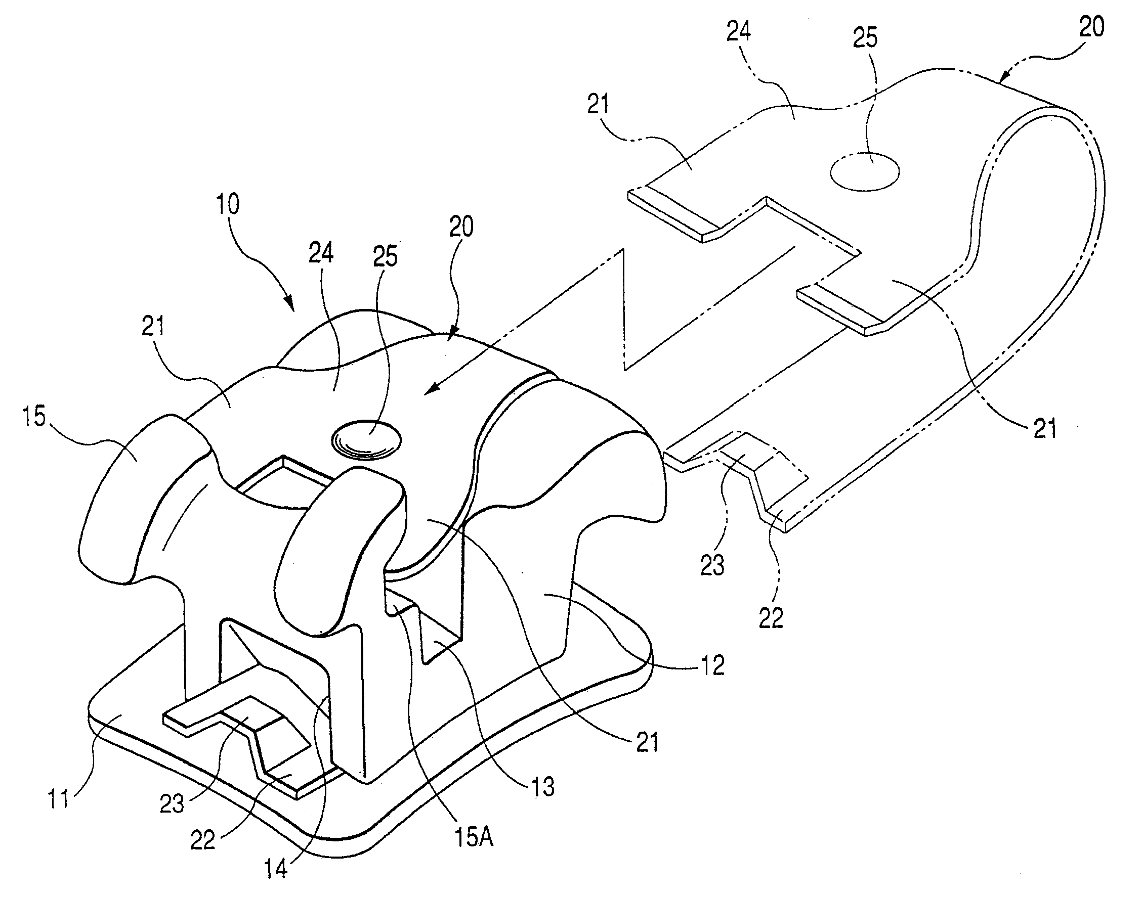 Orthodontic bracket and clip release tool