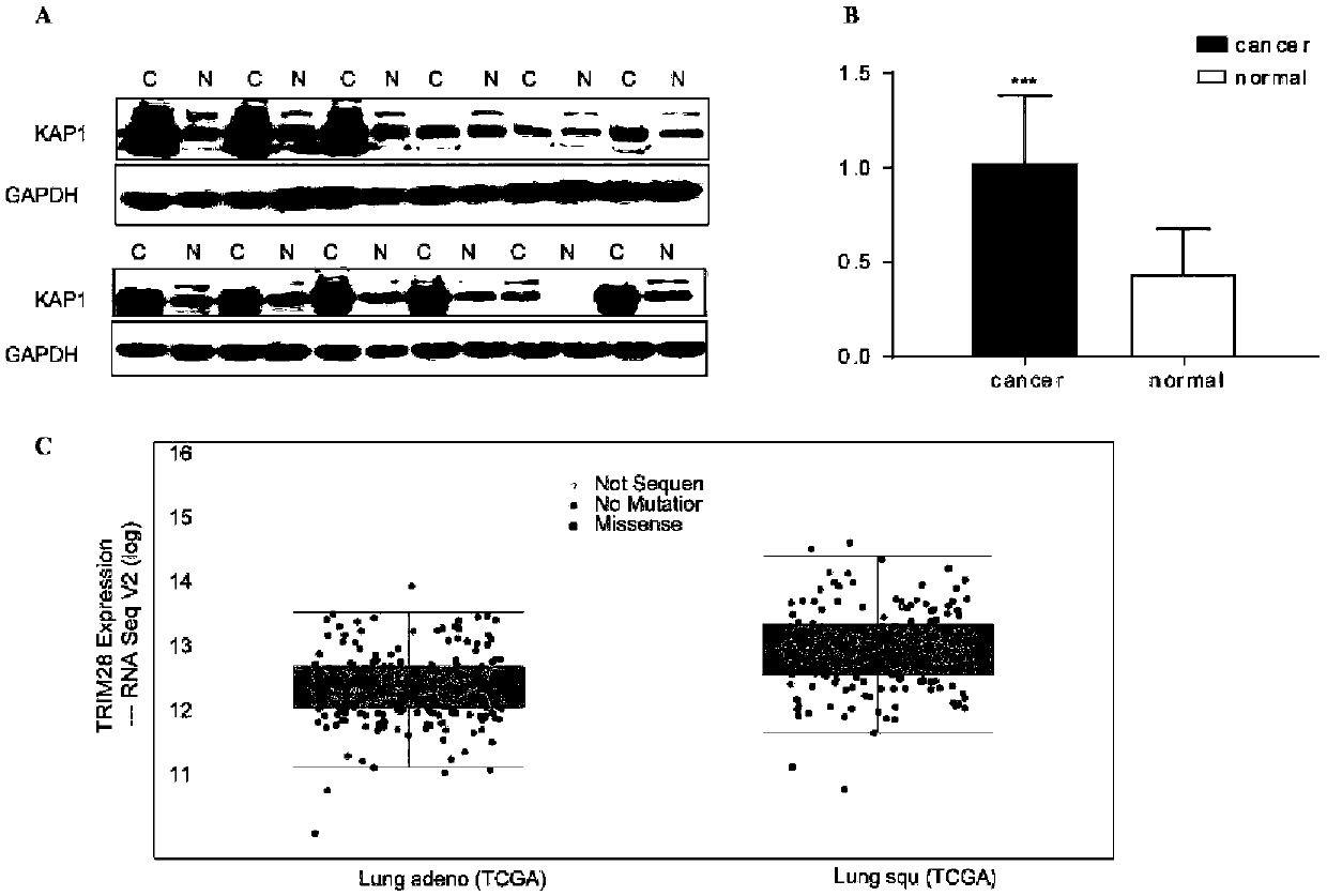 Inhibitor for targeted therapy of lung cancer, application of inhibitor as well as application of KAP1 as drug target in screening of anti-lung cancer drugs