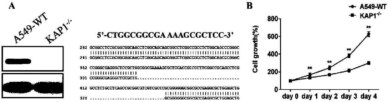 Inhibitor for targeted therapy of lung cancer, application of inhibitor as well as application of KAP1 as drug target in screening of anti-lung cancer drugs