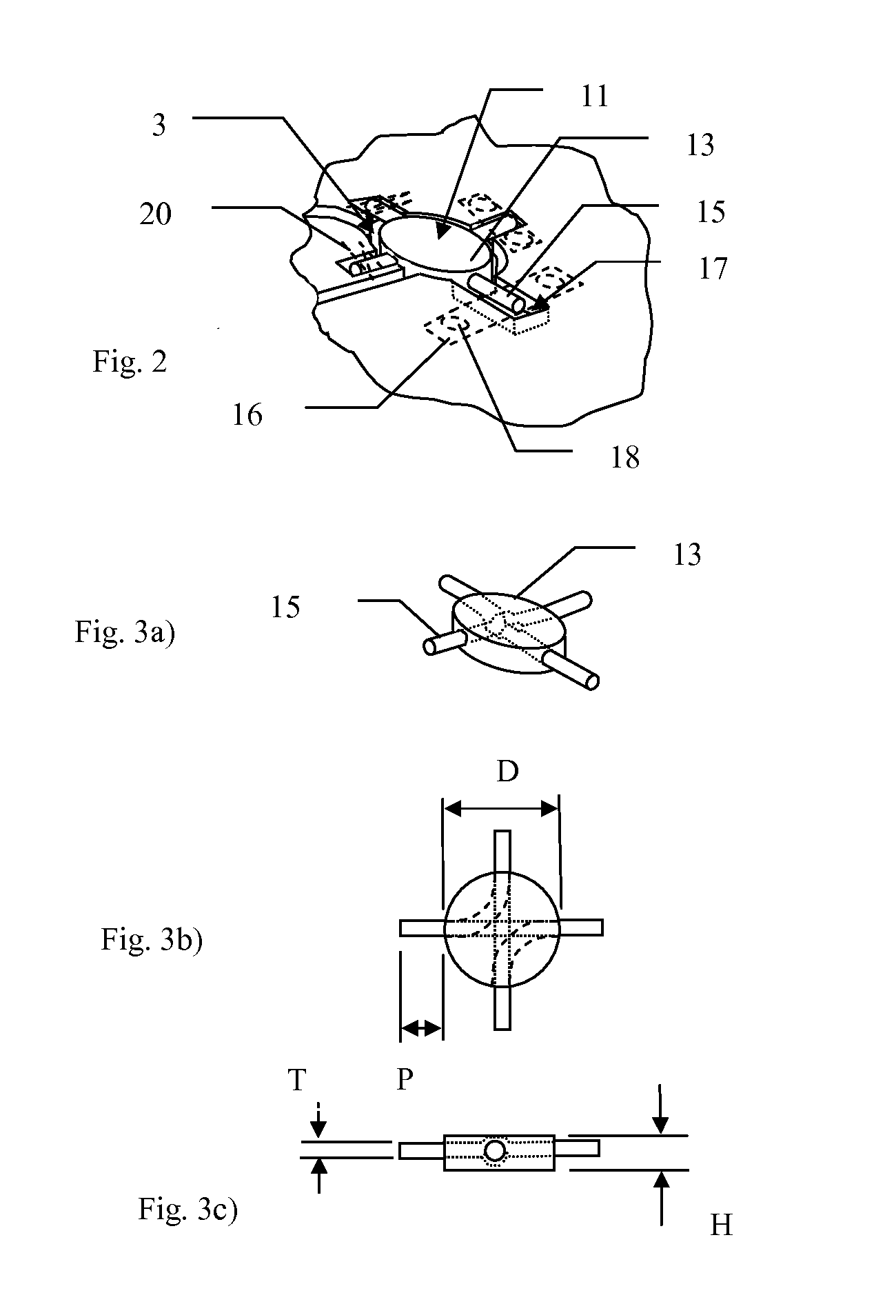 Implants and methods for using such implants to fill holes in bone tissue